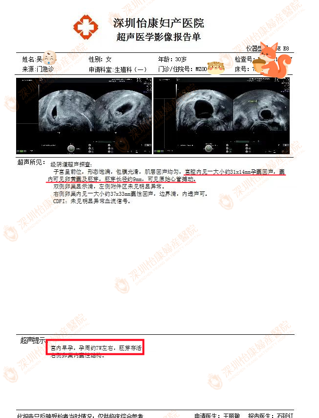 婚后怀不上找怡康求助  专家方案为她促成好孕