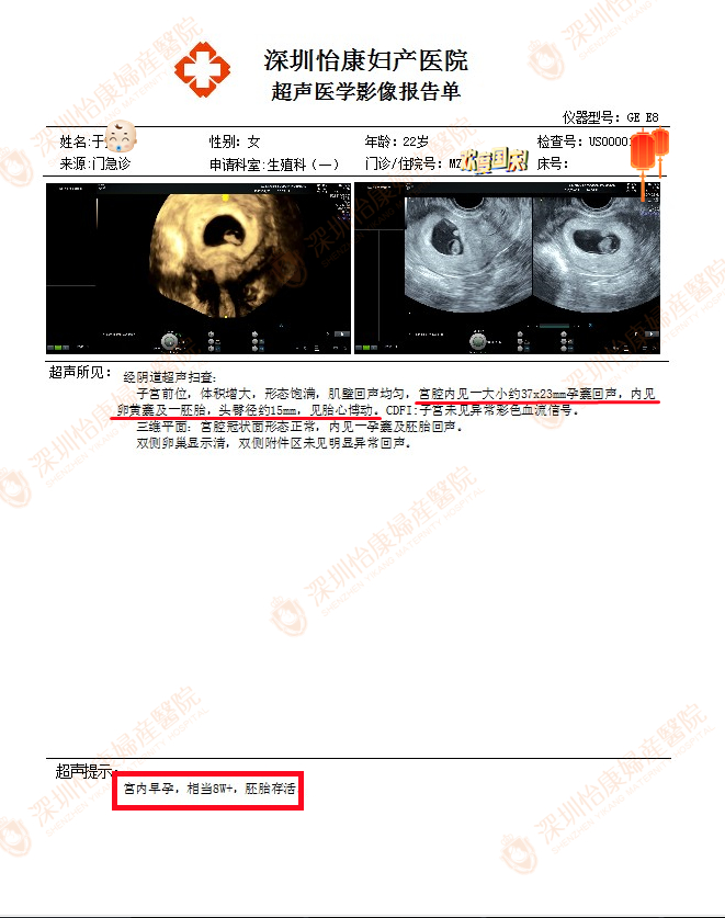 重庆幺妹儿喜孕8周+
