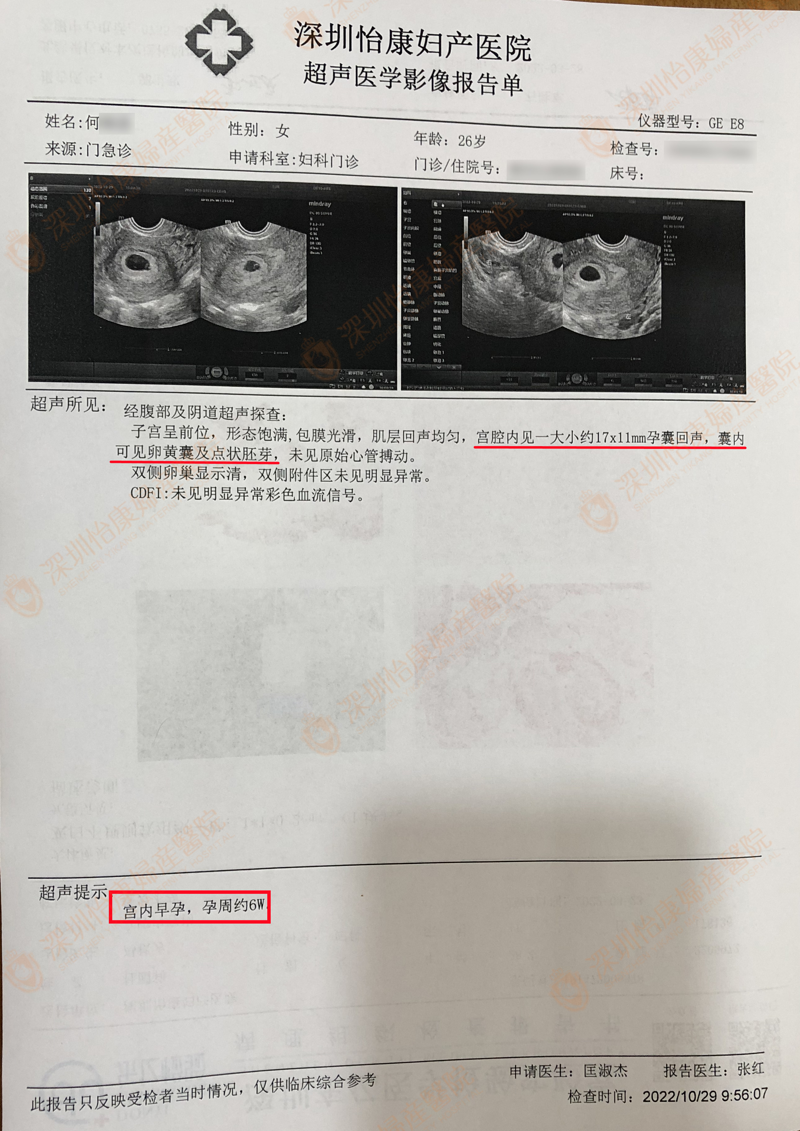 科学备孕到怡康 成功助孕六周+