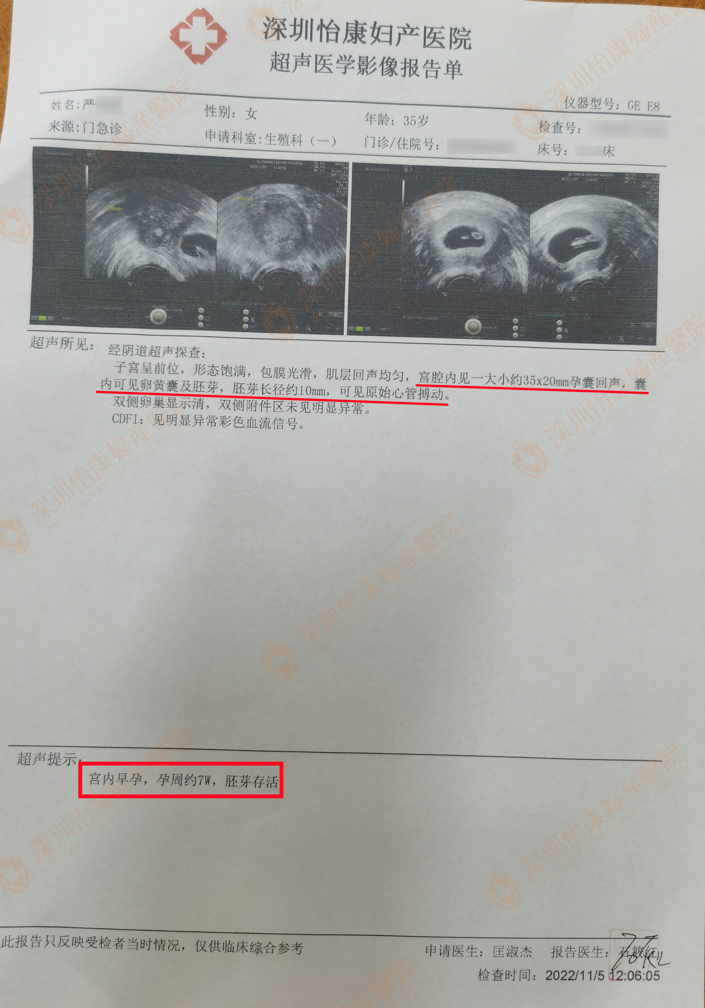 手术很成功+基础条件好=在怡康顺利好孕