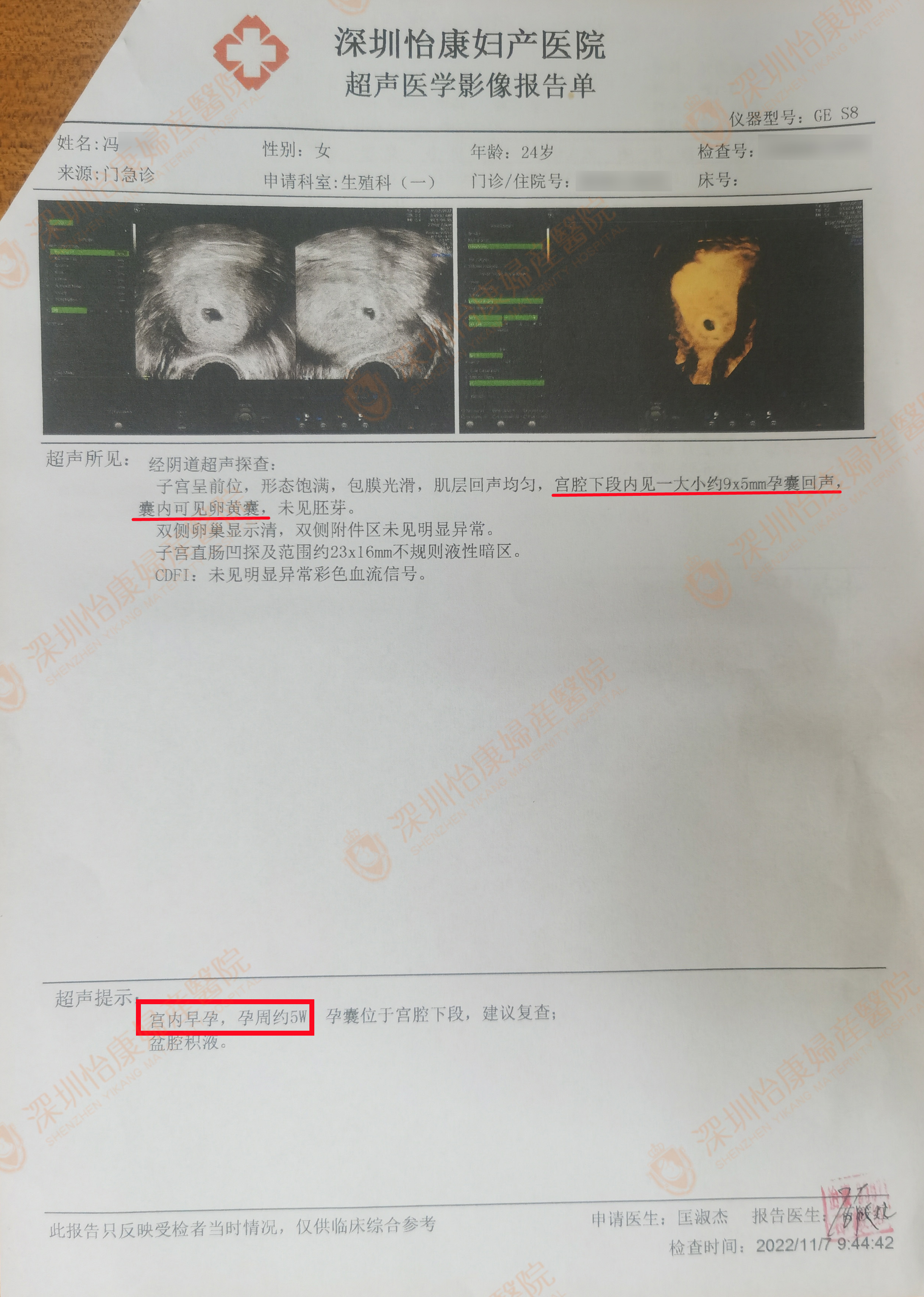 自己备孕无效来求助 1个月快孕没走弯路
