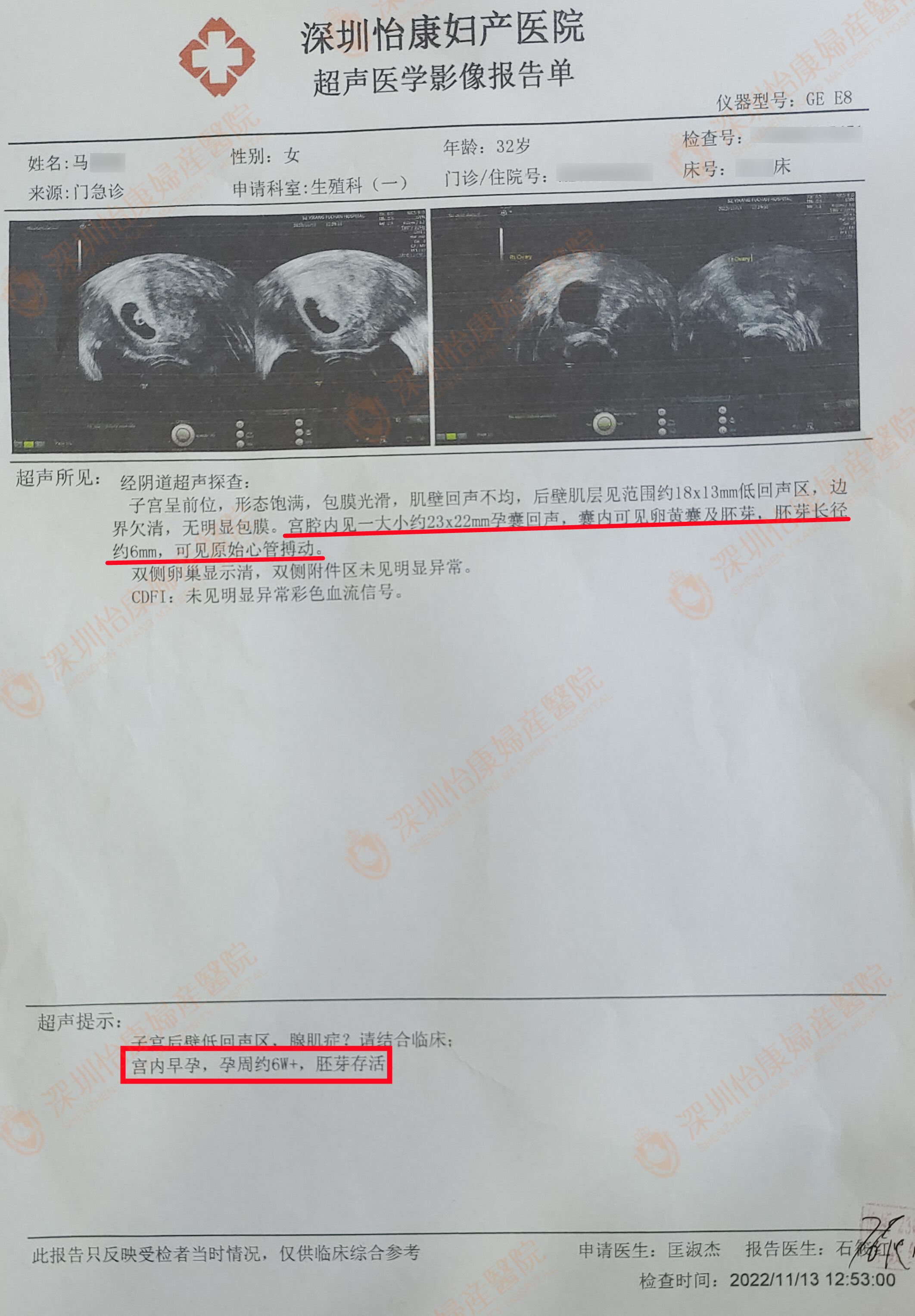 怀孕各环节都有问题 在怡康经治疗现好孕