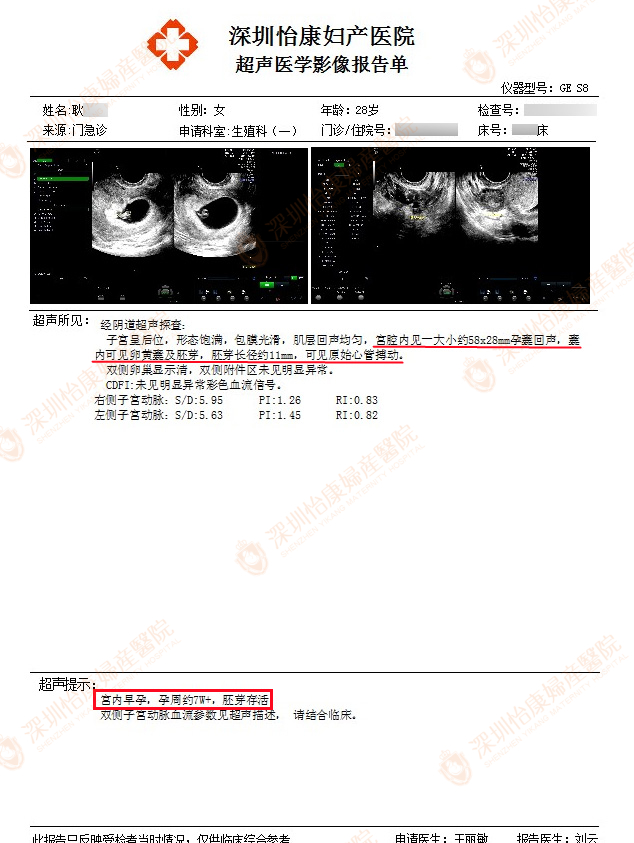 再次粘连怀孕难 怡康帮助圆喜孕
