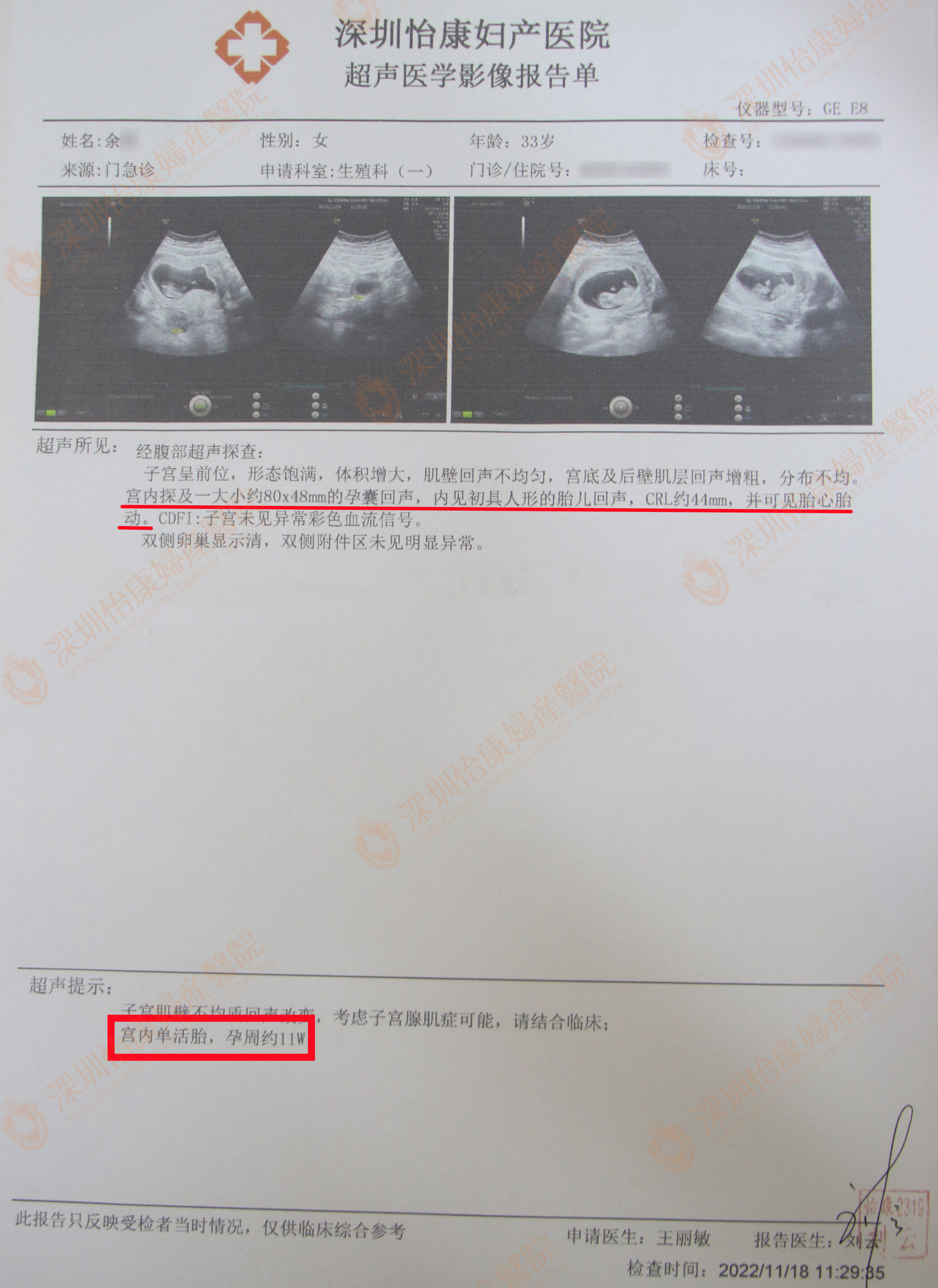 结婚9年 33岁还在备孕一胎 怡康送喜 专家护航到孕11周
