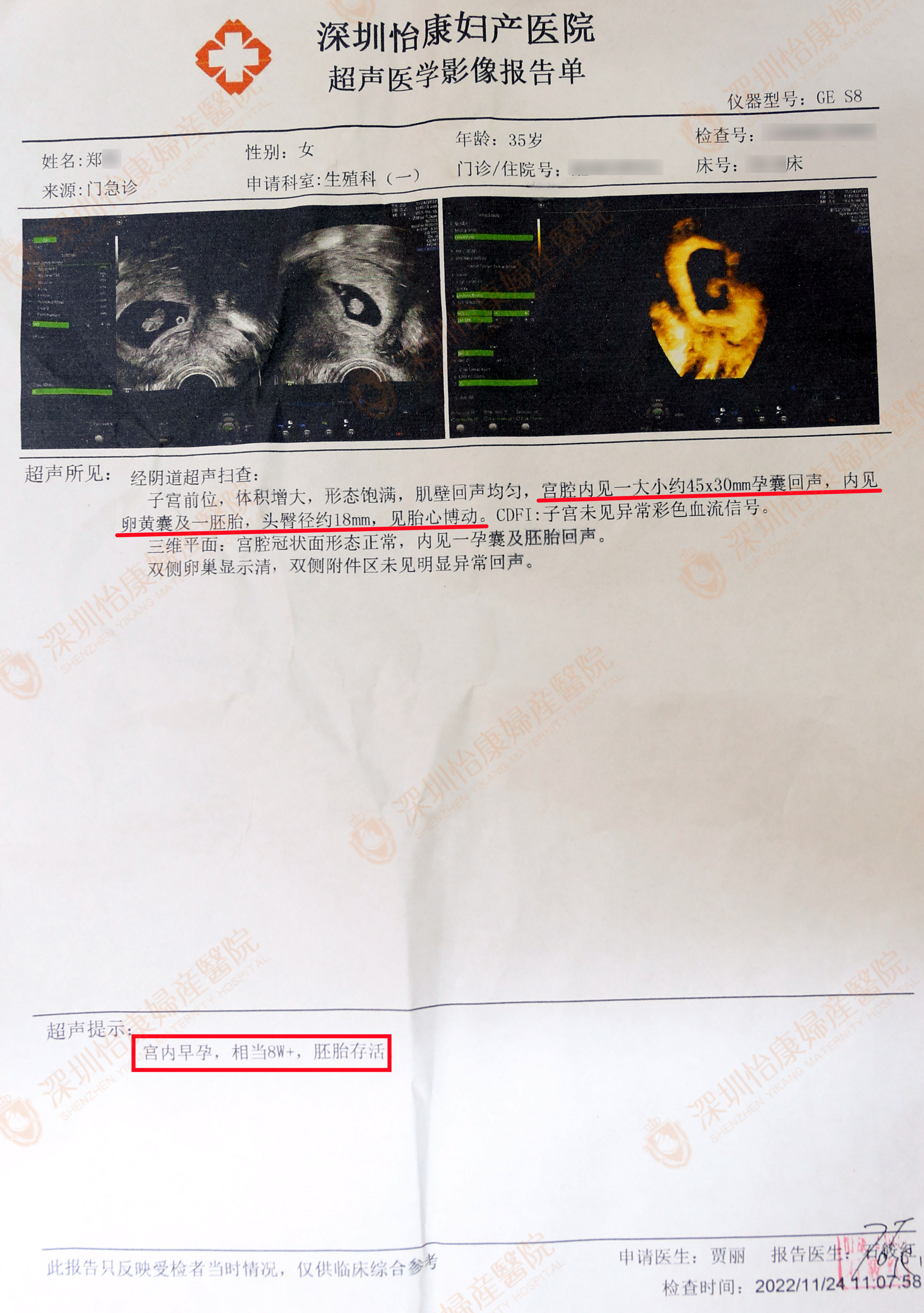 术后1个月“中奖” 效率杠杠滴