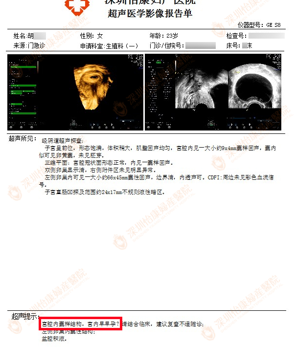 心态良好 促排2次就成了