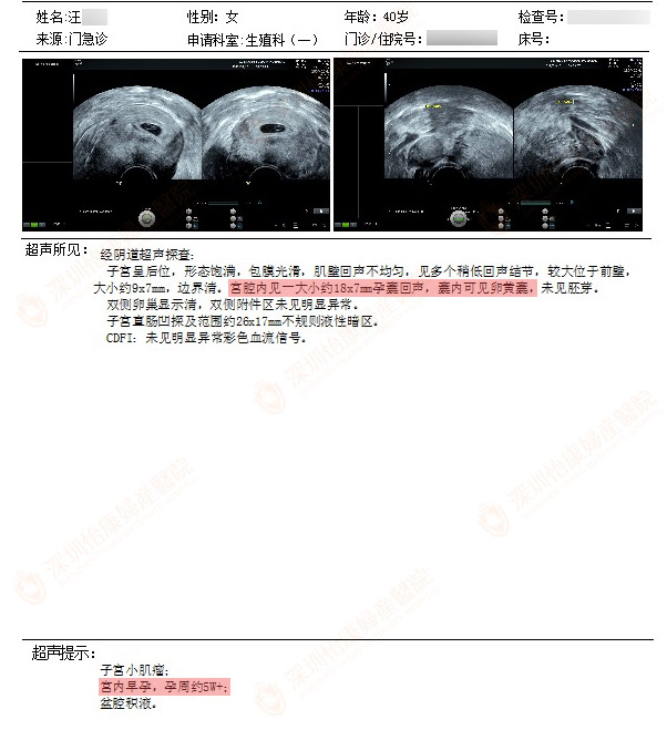 做好复通一箭双雕 顺其自然要宝宝 卵巢受益抗衰老