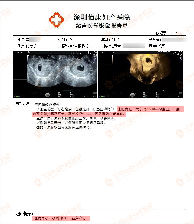 年前怡康助孕 年后快孕报喜