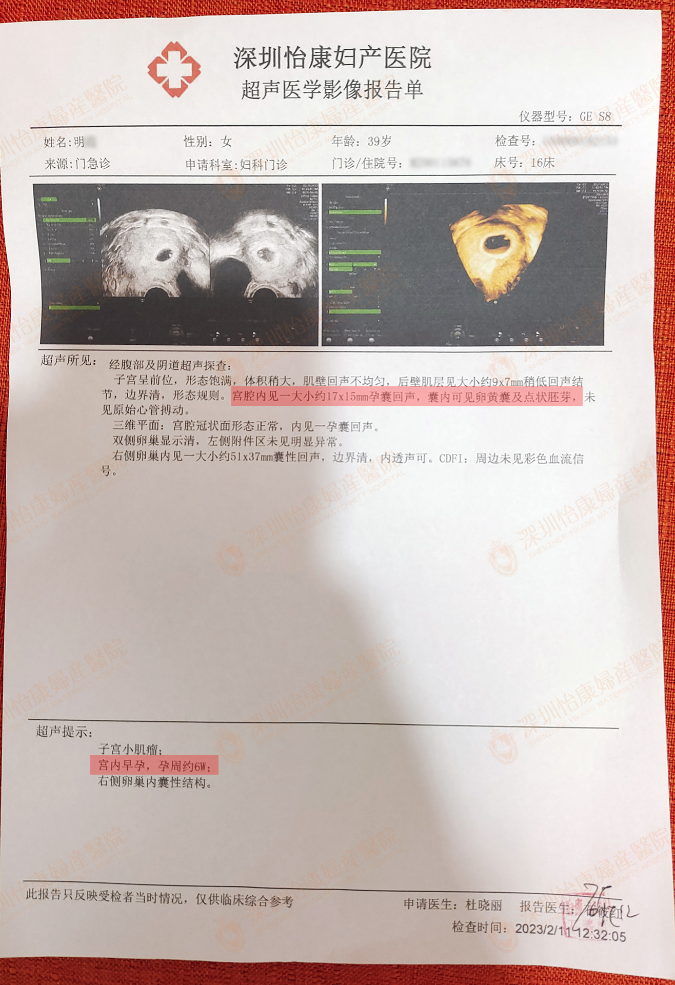 高龄备孕二胎6年未果 来怡康3个月喜得好孕