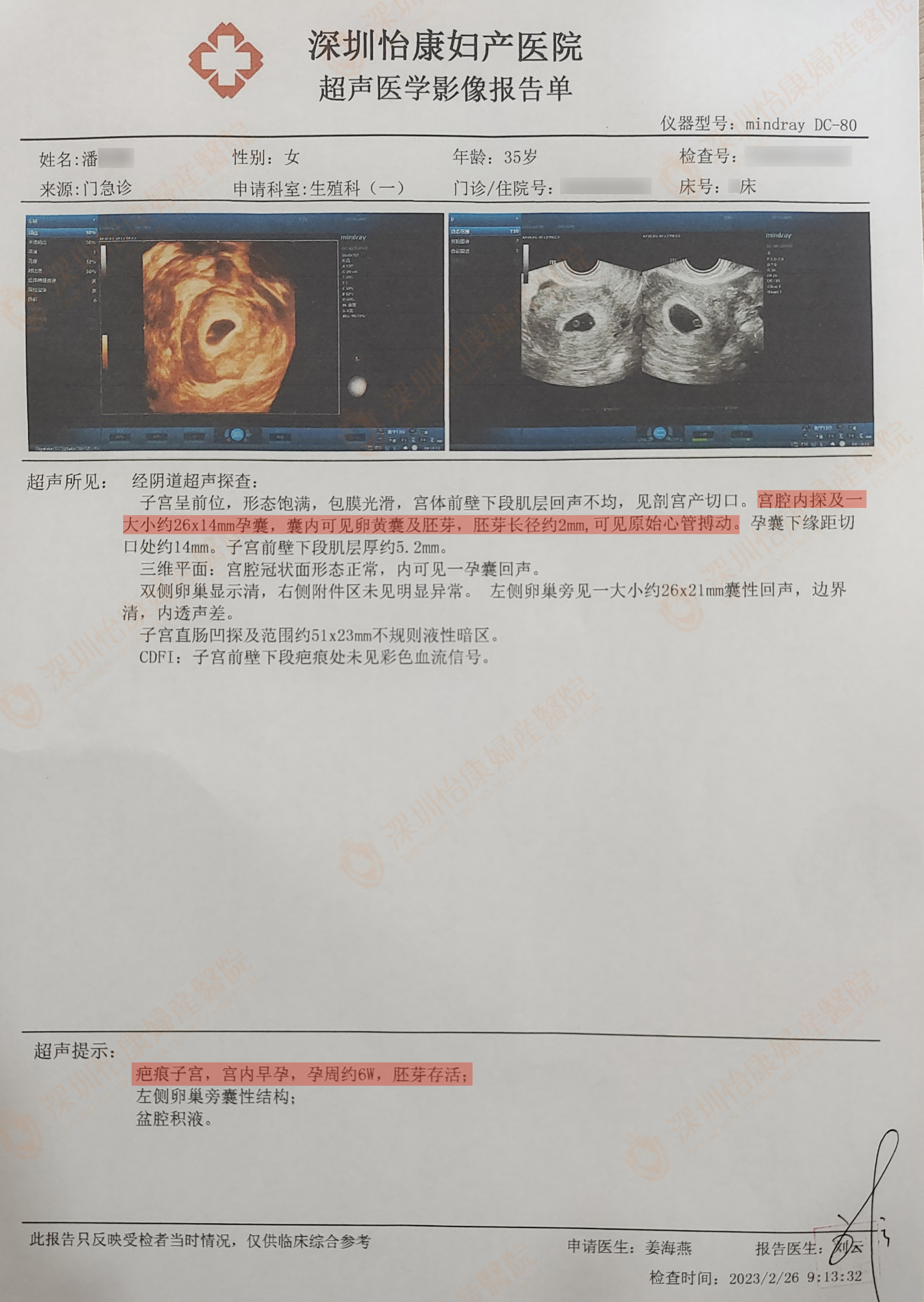 求孕心态对就能事半功倍